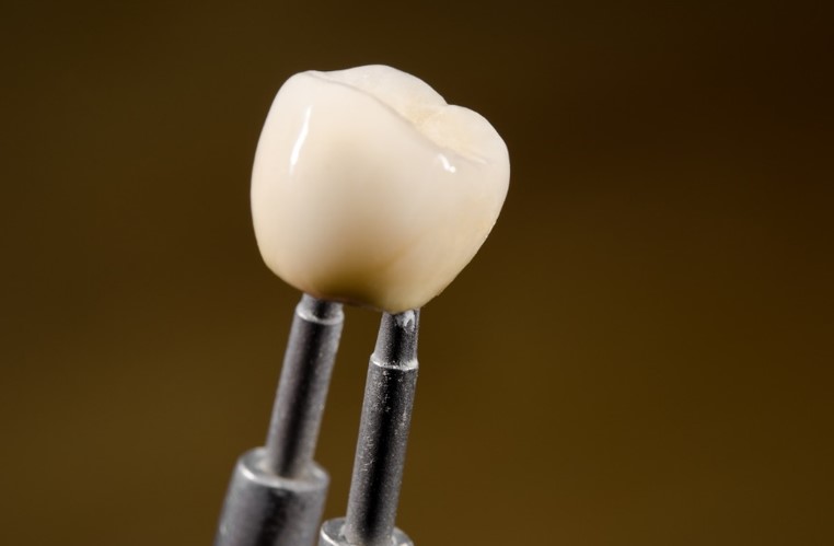 What Are Dental Implants And How Are They Performed In A Clinic?