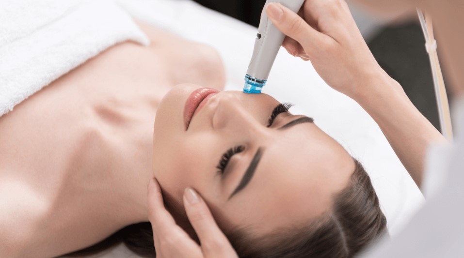 Facts About RF Micro-needling Treatments